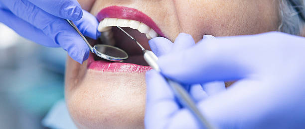 Best Chipped Tooth Repair Near Me  in Rosedale, MD